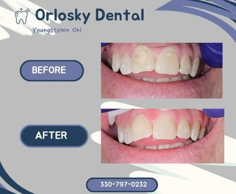 5. Social Media Marketing